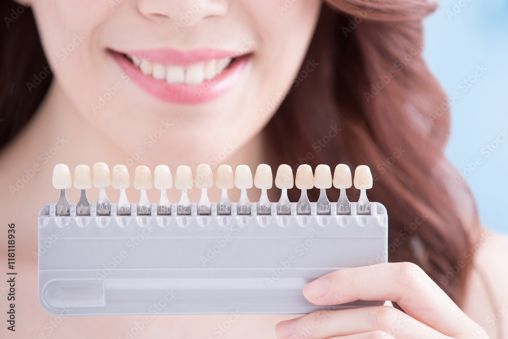 Woman teeth whitening concept