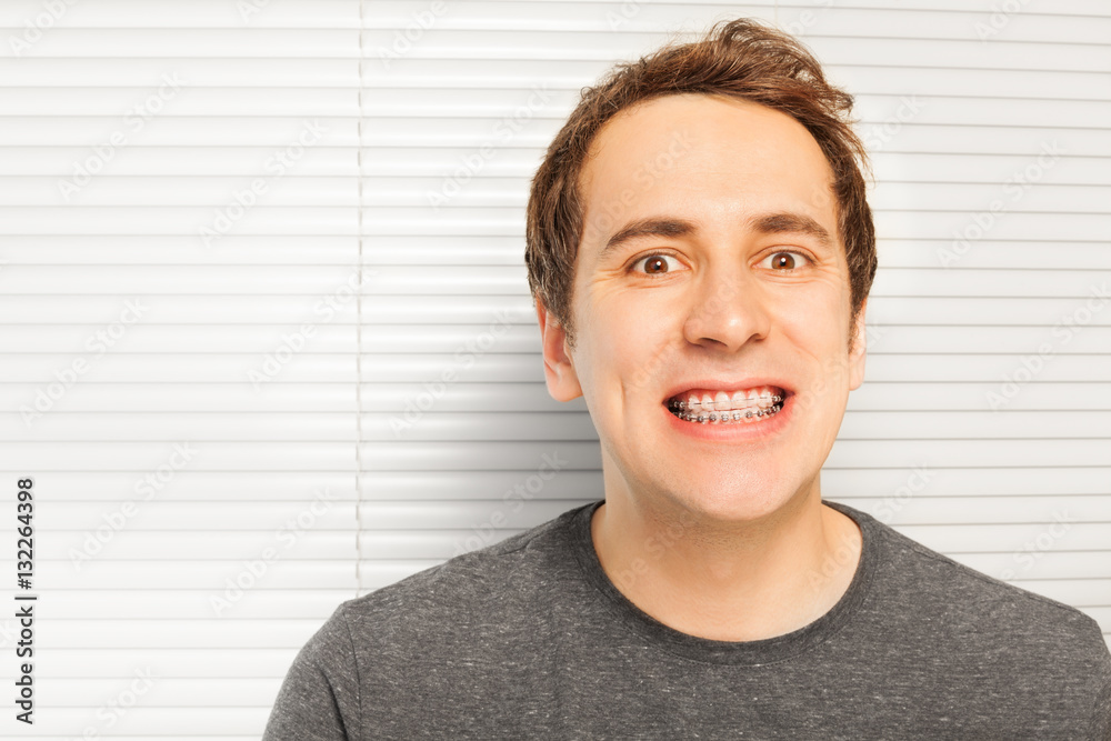 Portrait of smiling young man with dental braces