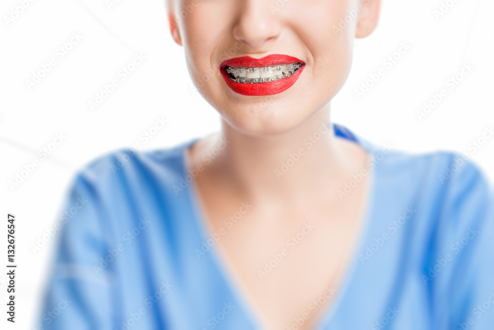 Close up view on womans smile with tooth braces on the white background