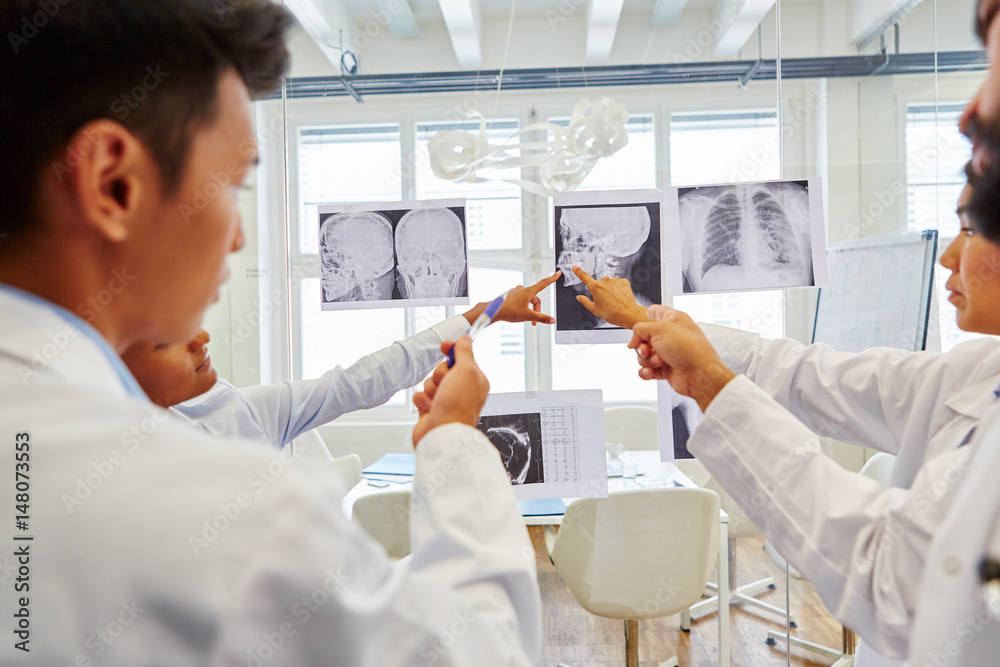 Radiologen Team diskutiert Röntgenbilder