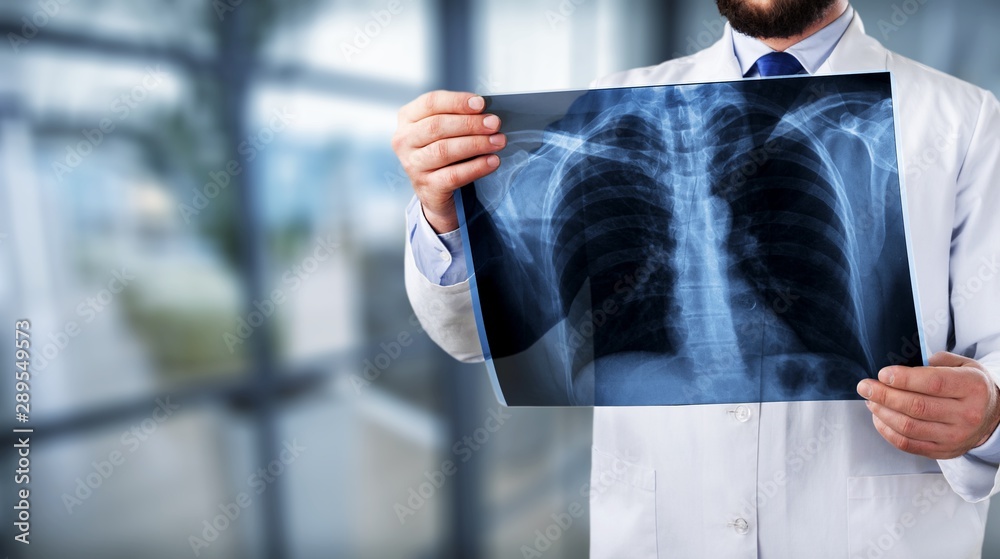 Young man doctor holding x-ray