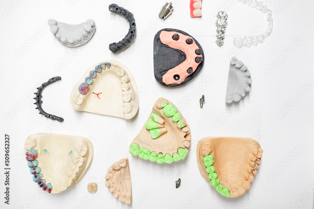 Various of artificial jaw models with dental implants and crowns on the white background, top view. 