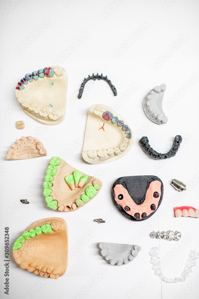 Various of artificial jaw models with dental implants and crowns on the white background, top view. 