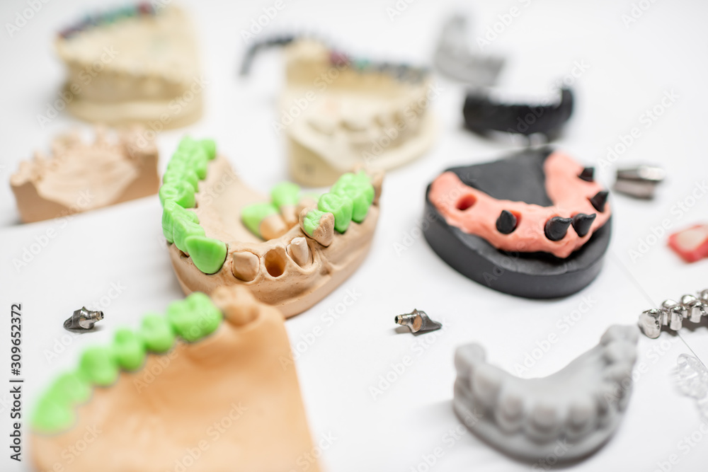白色背景上有种植牙和牙冠的各种人工下颌模型。概念