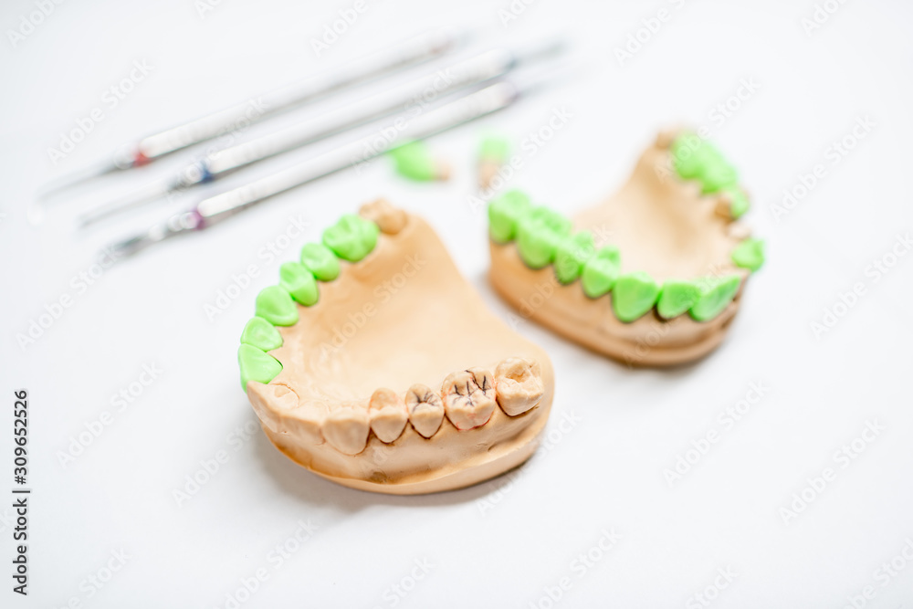 Plaster models of artificial jaw with teeth painted in green and dental tools on the white backgroun