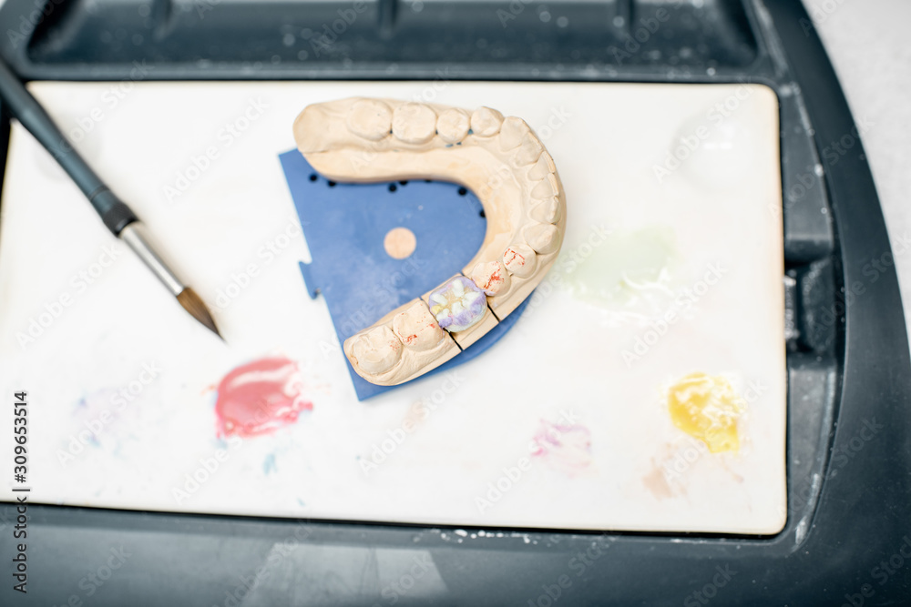 Colored dental prosthesis with a paint brush at the working place in the laboratory. Concept of impl