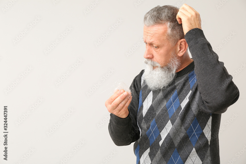 Senior man with hair loss problem on light background