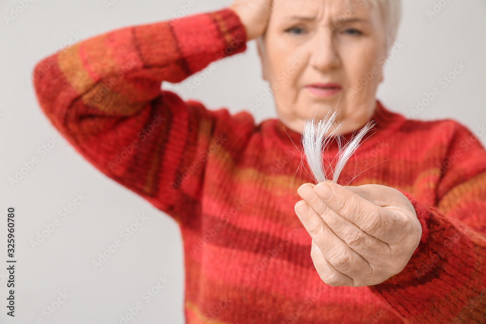 Senior woman with hair loss problem on light background