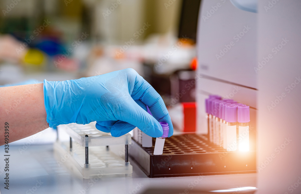 Scientist`s hands with test tubes. Examining samples and liquid for DNA research.