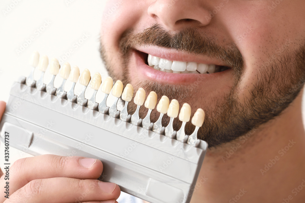 Young man with teeth color samples on white background, closeup