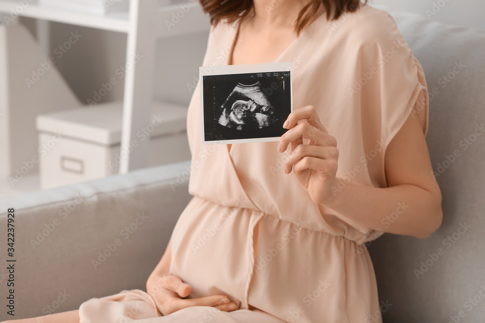 Beautiful pregnant woman with sonogram image at home