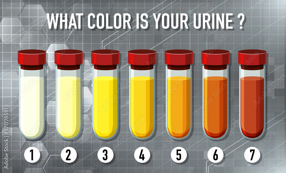 尿液颜色图表图解