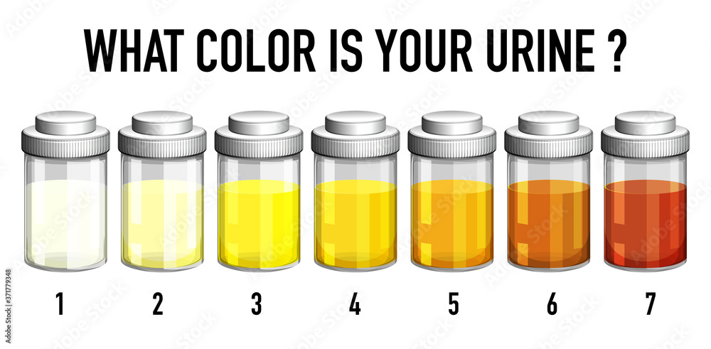 尿液颜色图表图解