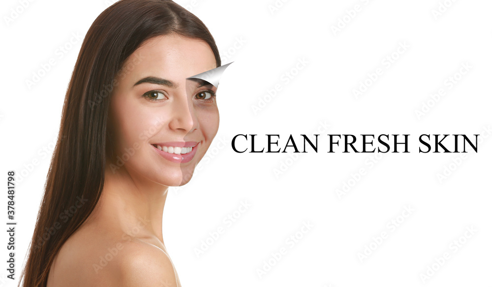 Young woman before and after facial cleansing procedure on white background