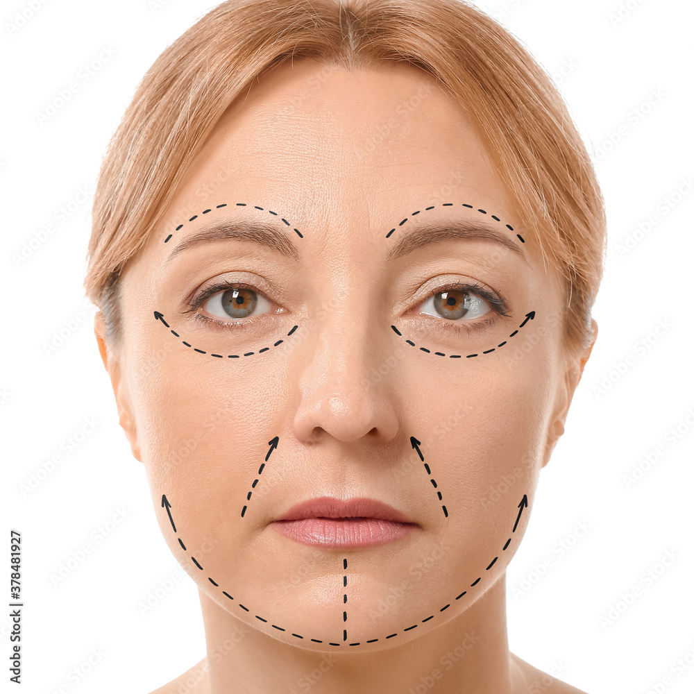 Mature woman with marks on her face against white background. Plastic surgery concept