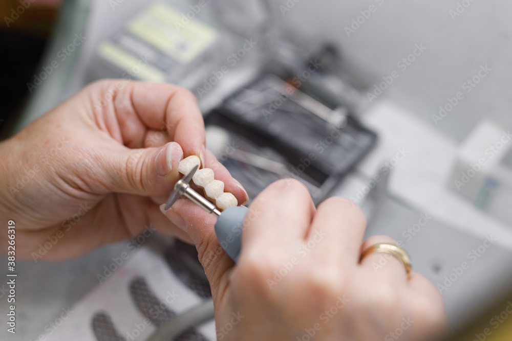 Technician working on prosthetic bridge with drill.