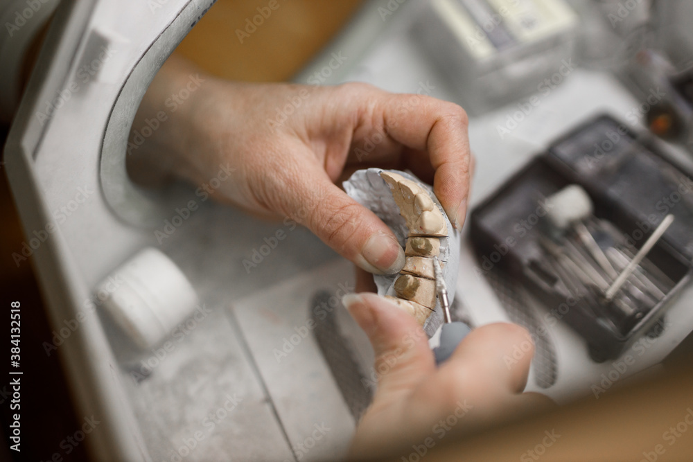 Technician working with plaster model and dental equipment.