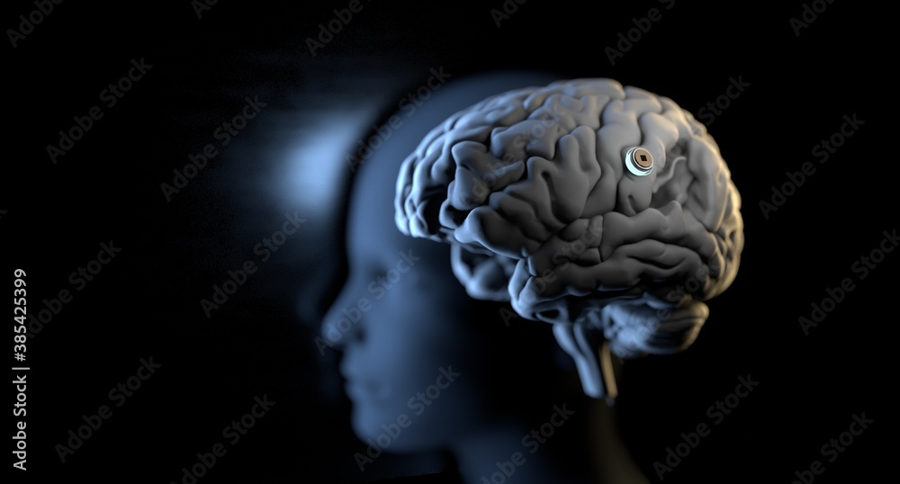 Neurotechnology, implantable brain machine, chip inserted into brain.