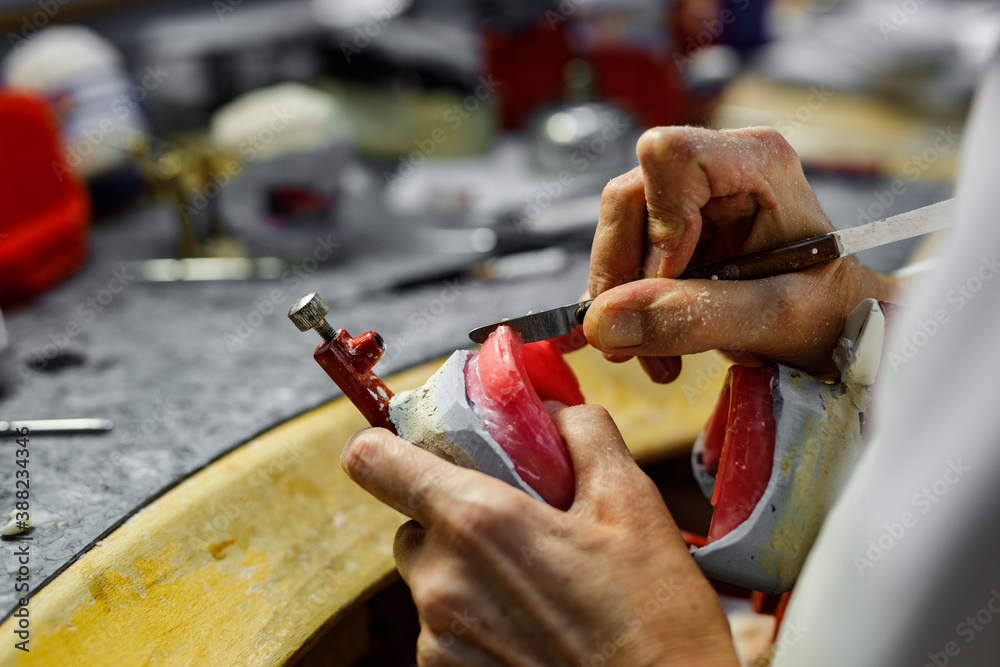 Dentist hands with plaster model, working.