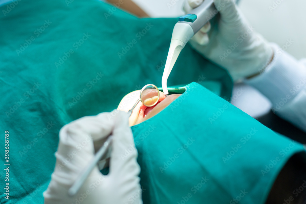 Close up hand dentist check teeth milk tooth of Child is sitting in a dental chair inspecting her te