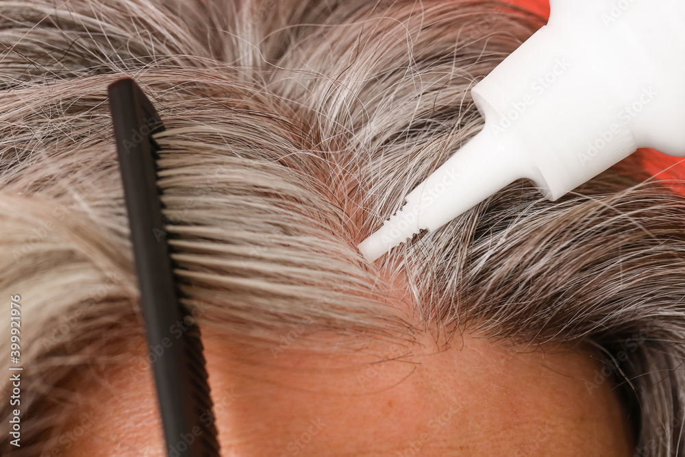 Senior man using serum for hair loss treatment, closeup