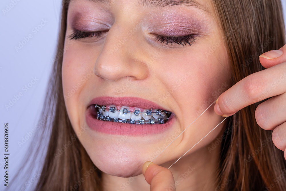 Close up portrait of a happy teen girl with braces and beautiful smile on white background