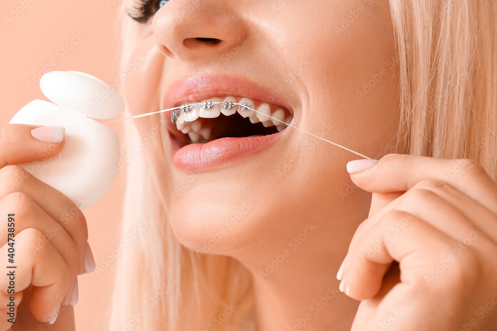 Young woman with dental braces and floss on color background