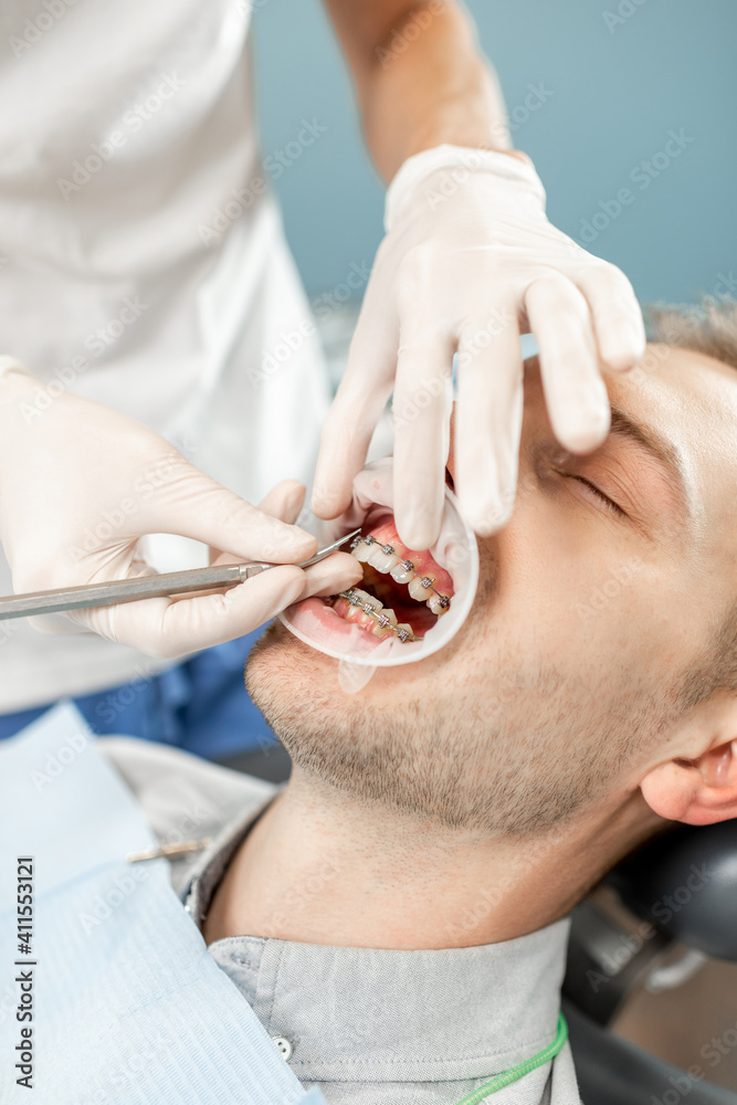 Young male patient with dental braces during a regular orthodontic visit. Dentist adjusting orthodon