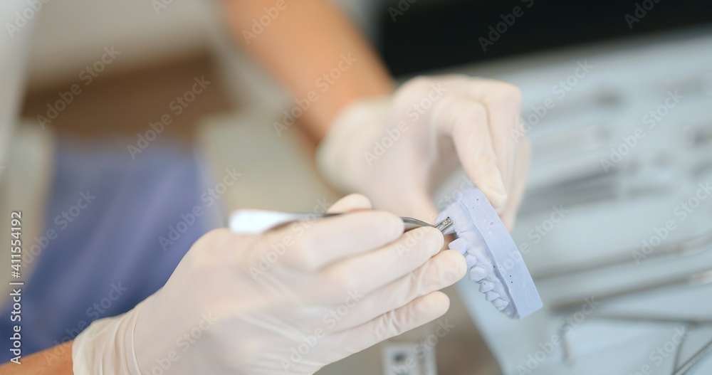 Orthodontist working with jaw model applying brace system, modeling orthodontic treatment for a pati