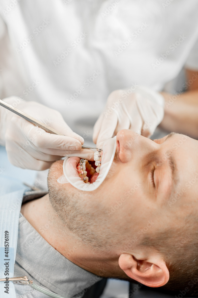 Young male patient with dental braces during a regular orthodontic visit. Dentist adjusting orthodon