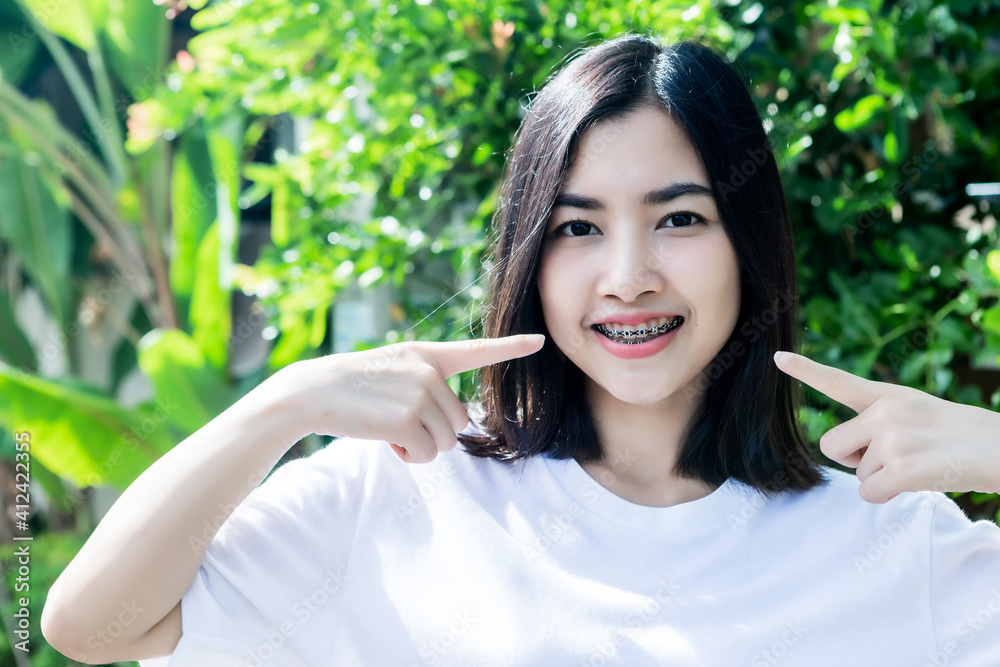 Asian woman wearing dental braces pointing to tooth sample and smiling with her healthy white teeth