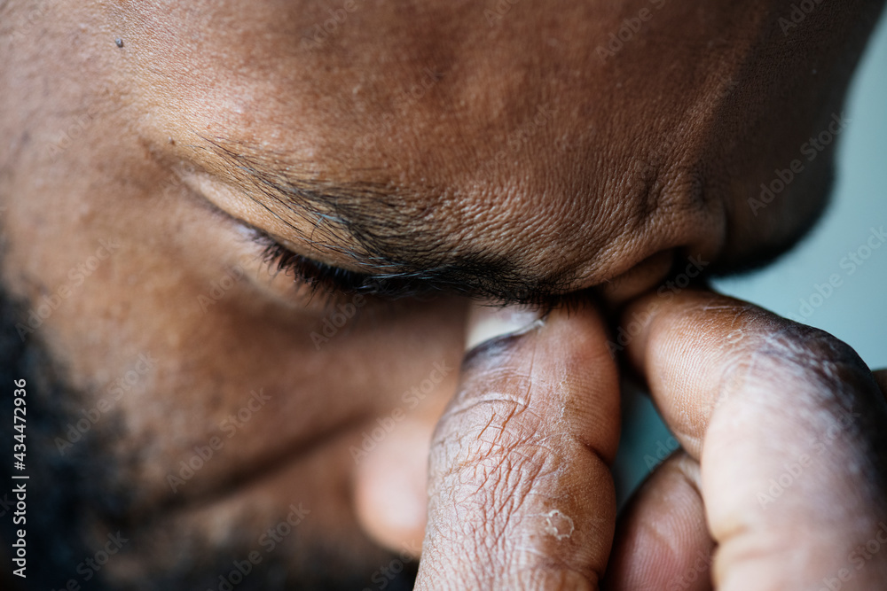 Portrait of stressed black man