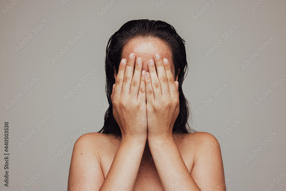 Close up of woman hiding her face with hands