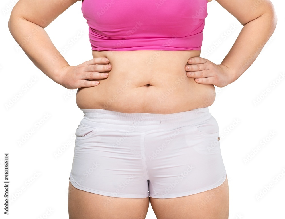 Overweight lady standing with stomach exposed