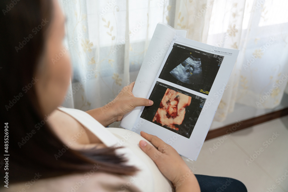 Asian young pregnant woman looking at ultrasound image, x-ray pregnant.