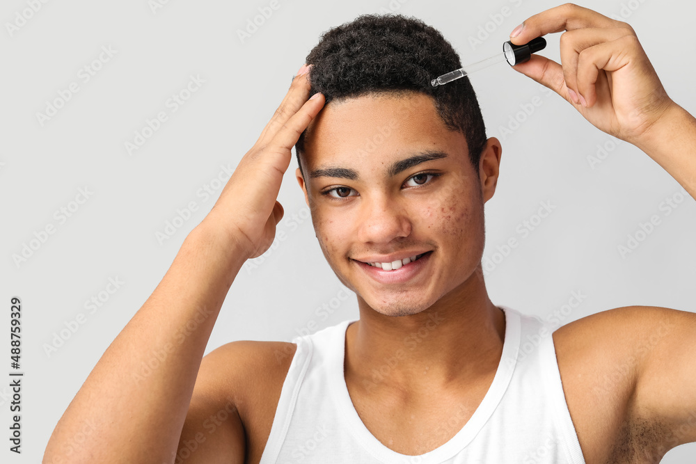 Young African-American guy using serum for hair growth on grey background