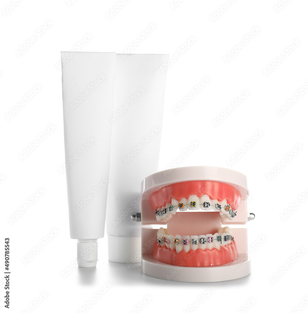 Model of jaw with braces and tooth paste isolated on white background