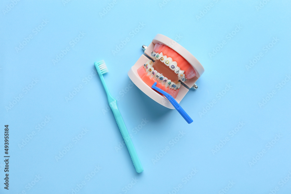 Model of jaw with dental braces and tooth brushes on blue background