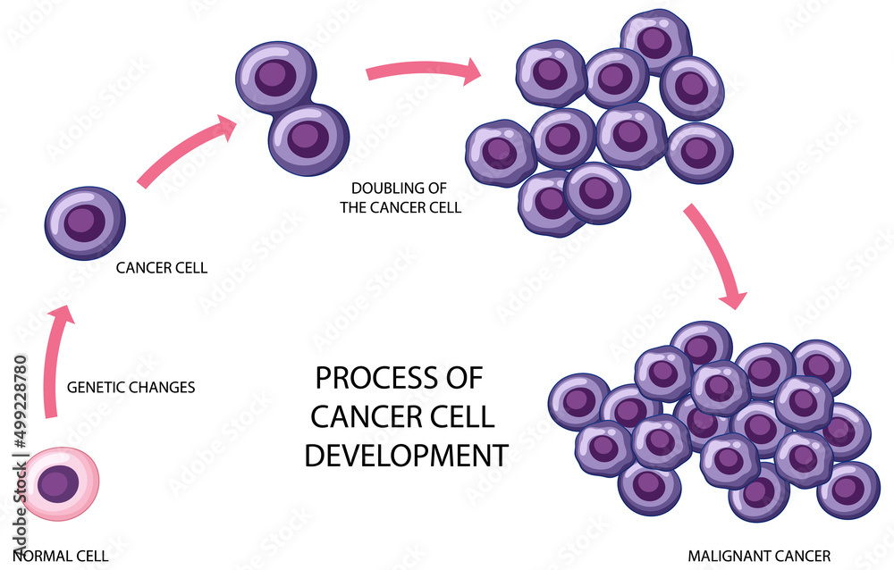 Process of cancer cell development