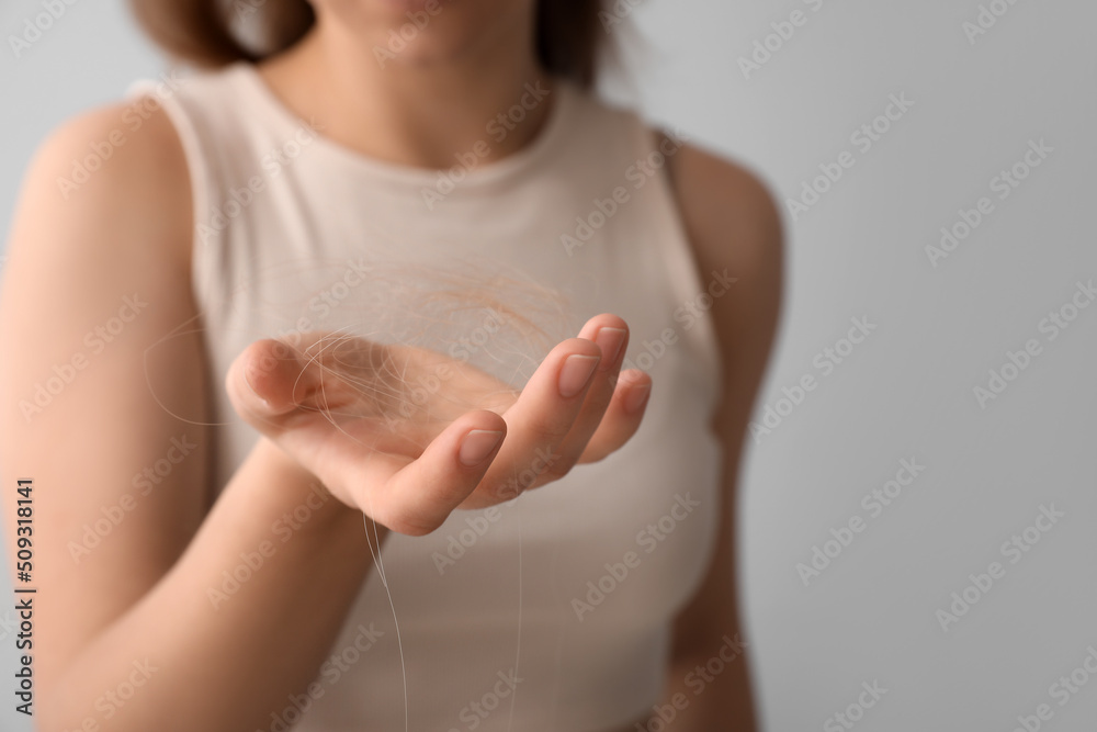 Young woman with hair loss problem on light background, closeup