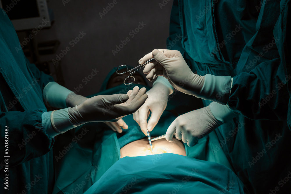 Image of surgical team perform surgery operation, nurse hand out sterile scissors to surgeon as supp