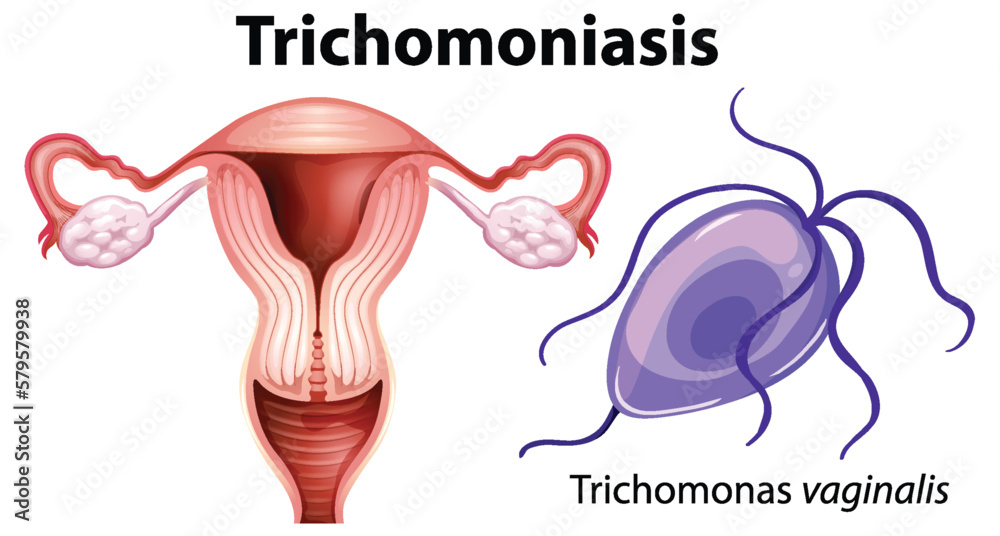 Trichomonas vaginalis on white background