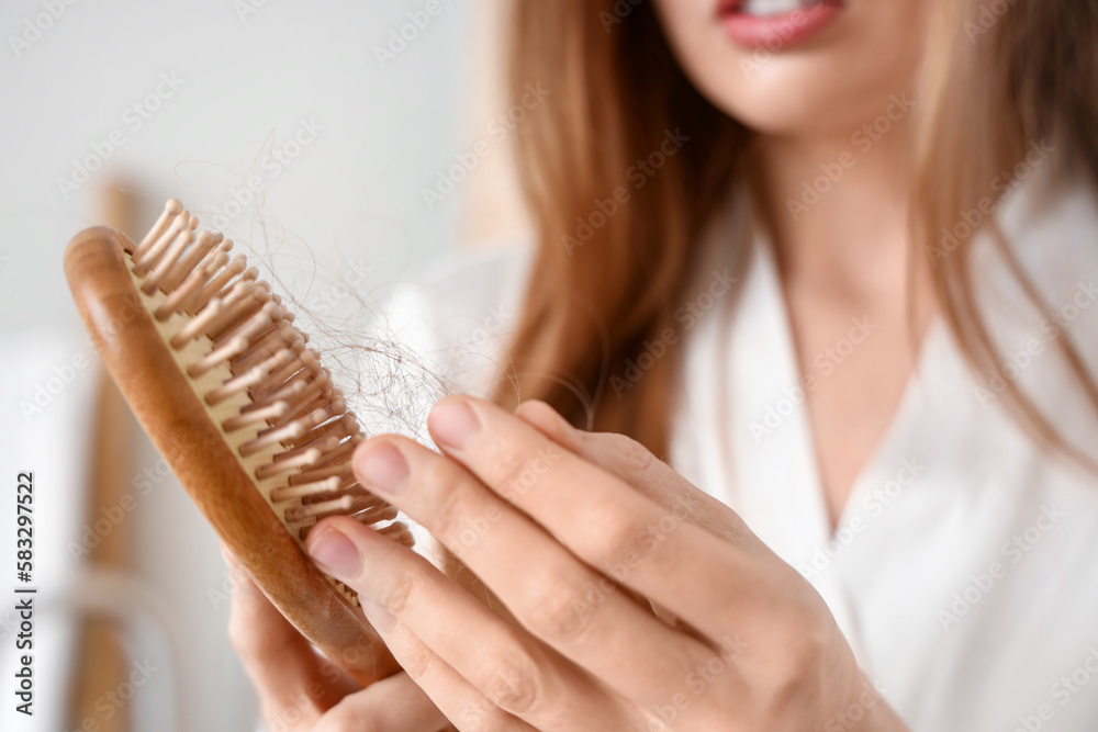 Young woman with hair loss  problem at home, closeup