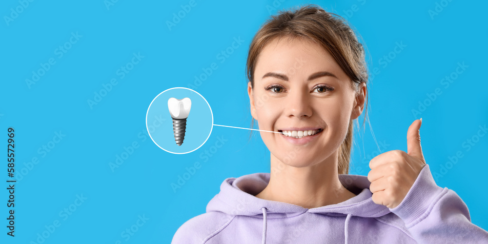 Young woman with implanted teeth showing thumb-up gesture on blue background