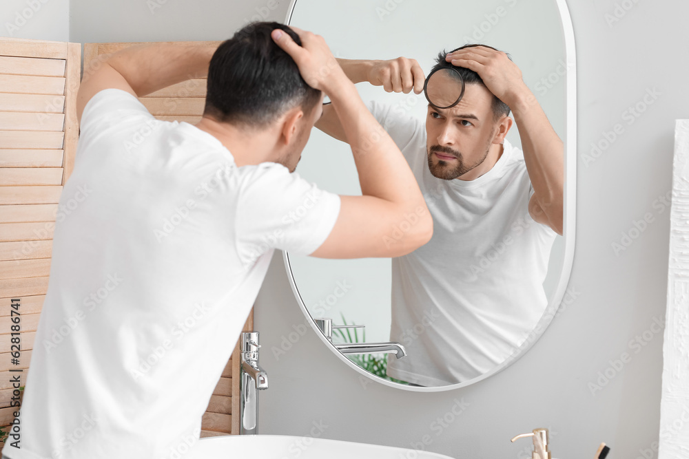 Handsome man with hair loss problem and magnifier looking in mirror at home