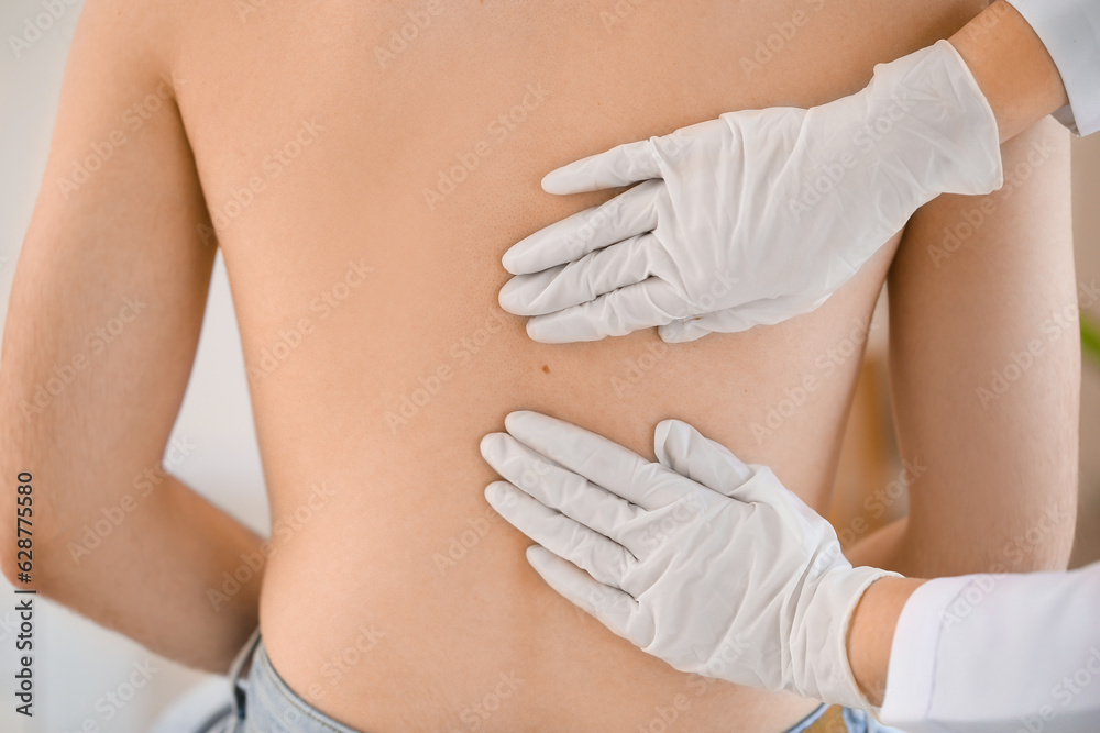 Dermatologist examining mole on young mans back in clinic, closeup