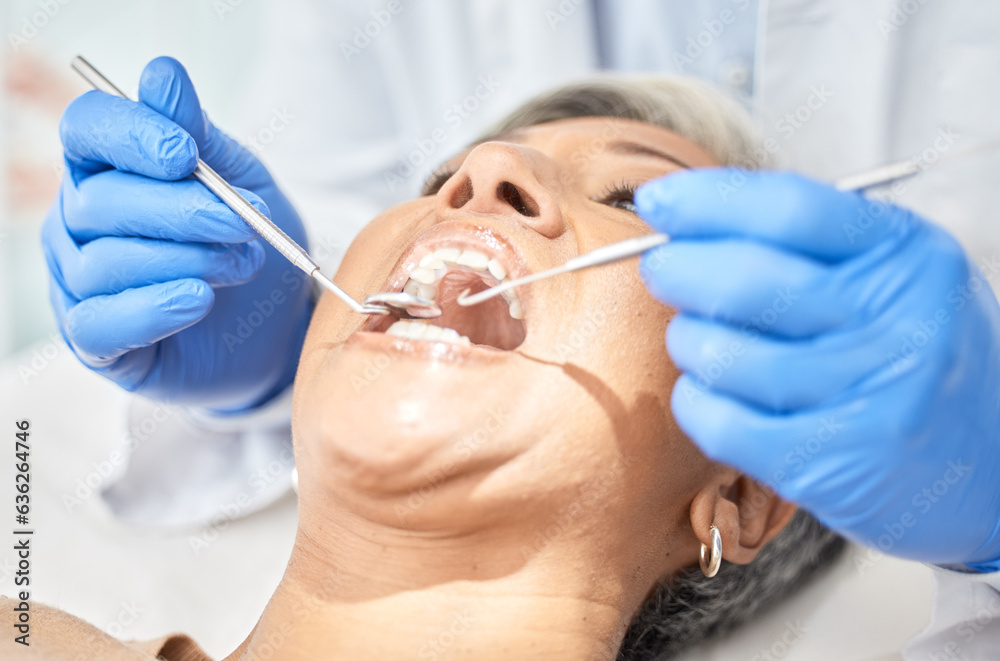 Woman, mouth and dentist hands with tools, medical and dental procedure, healthcare and closeup. Ora