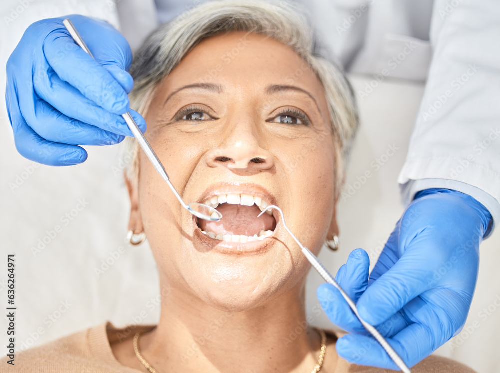 Healthcare, consulting and teeth with woman at dentist for oral hygiene, cleaning and medical. Exam,