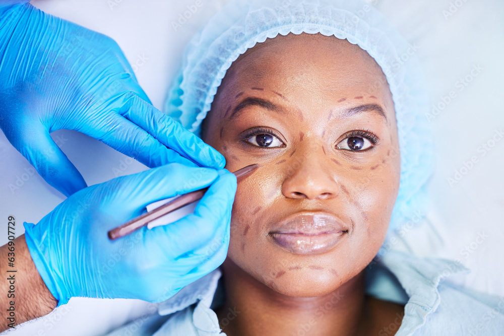 Plastic surgery, pen and black woman portrait on a hospital bed with dermatology with face mark. Sur