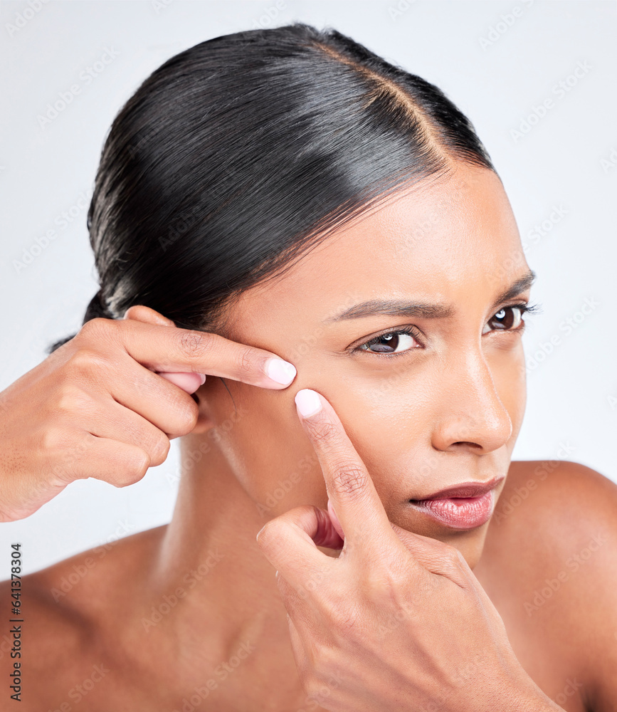 Woman, face and squeeze acne in studio of breakout, dermatology or worry of scar on white background